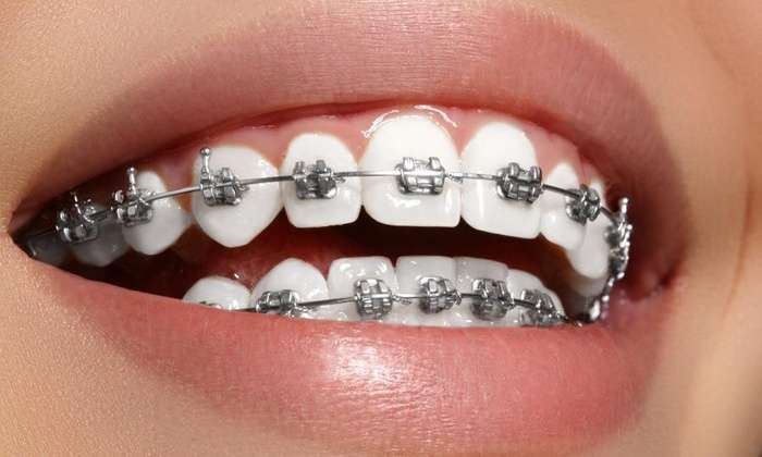Macchina fotografica sui denti puzzle online