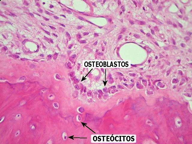 Osteoblasts online puzzle
