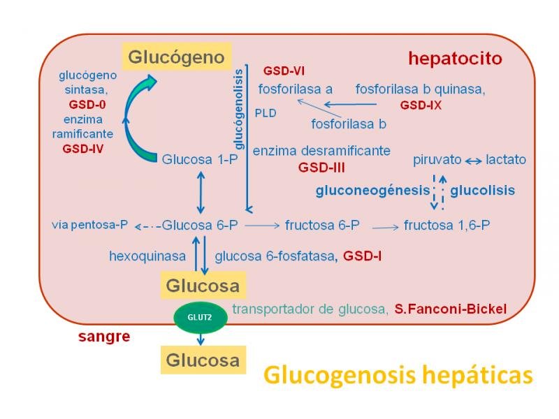 glucogeonosis hepatica rompecabezas en línea