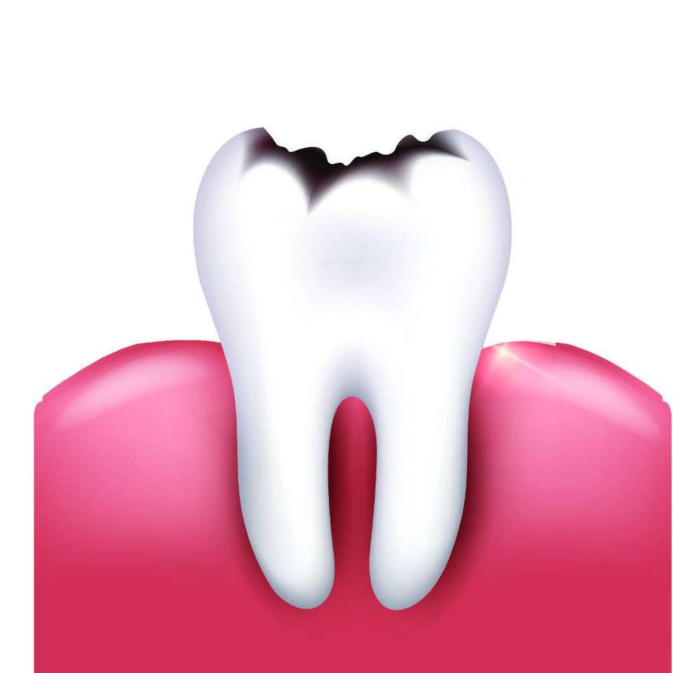 Mein Zahn tut weh 16 Online-Puzzle