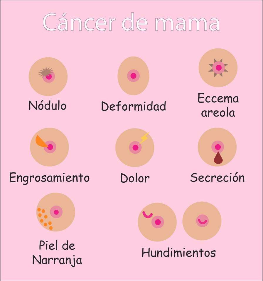 Рак на гърдата онлайн пъзел