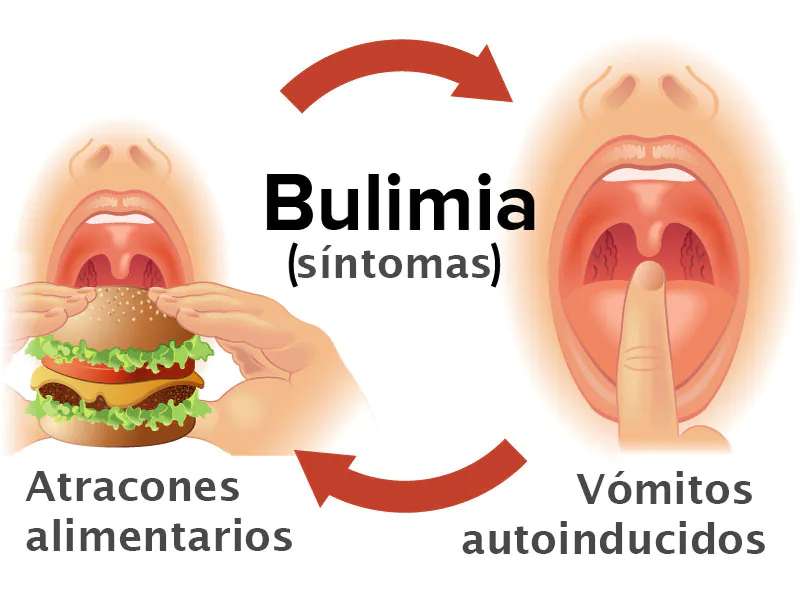 Bulimia Nervosa puzzle online
