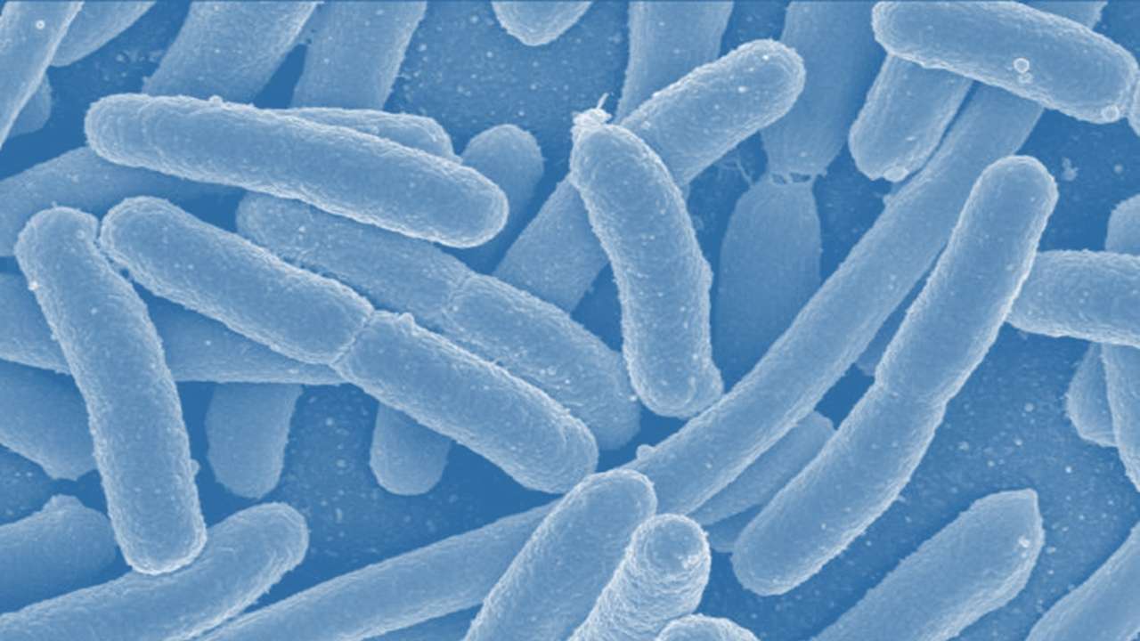 Escherichia coli online puzzle
