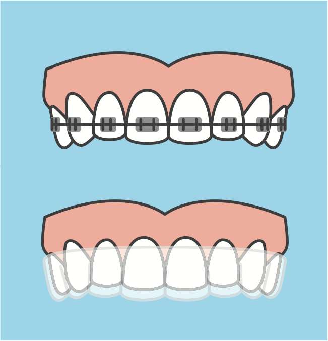 Principios de ortodoncia rompecabezas en línea