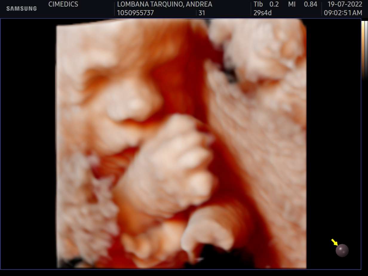 baby in echografie legpuzzel online