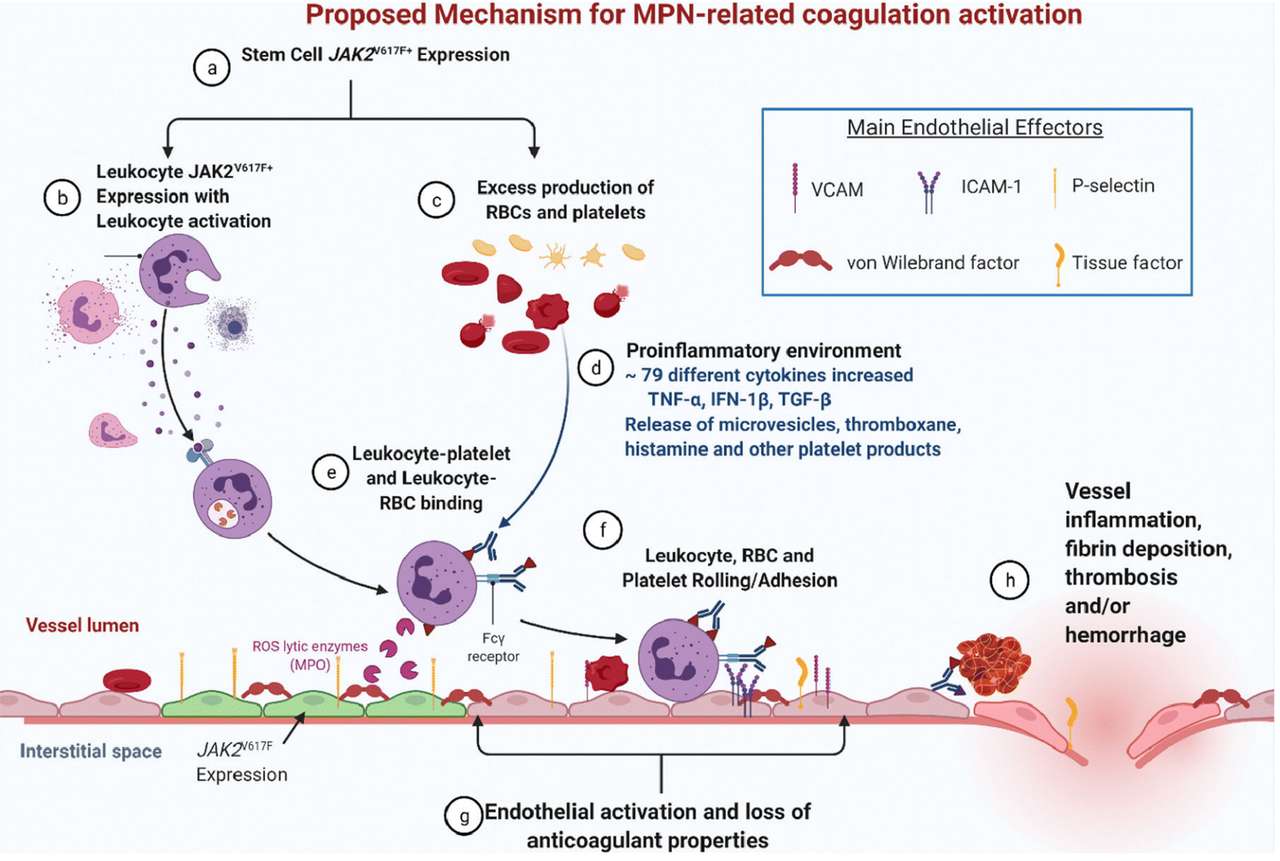 myeloproliferatieve neoplasmata online puzzel