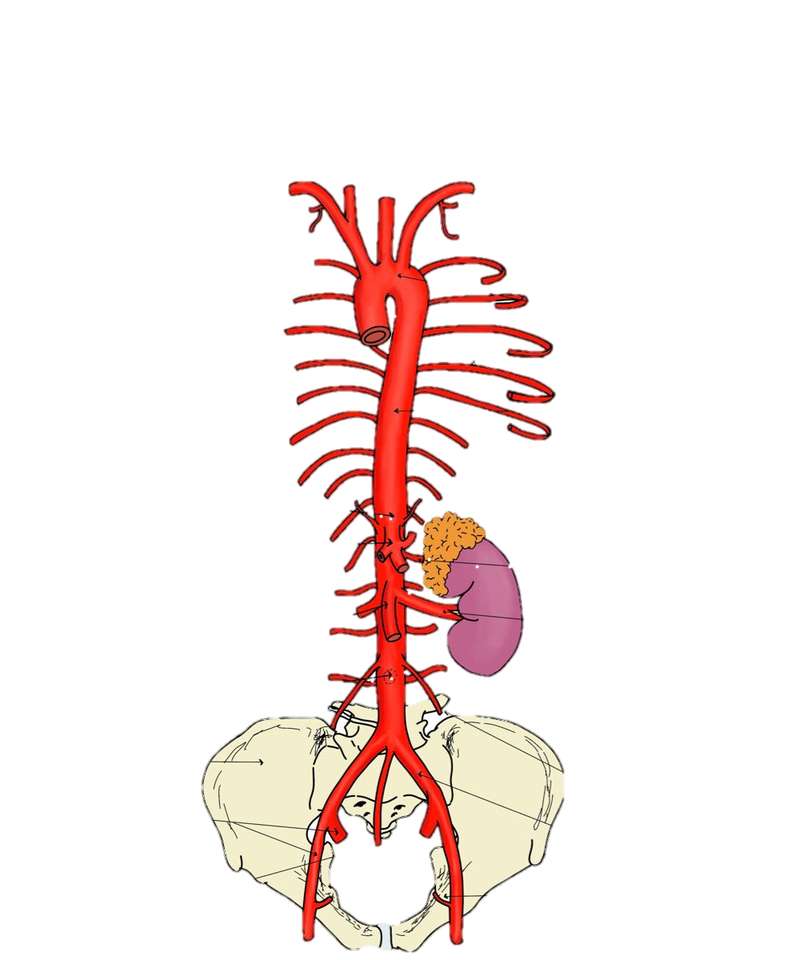 Abdominale aorta legpuzzel online