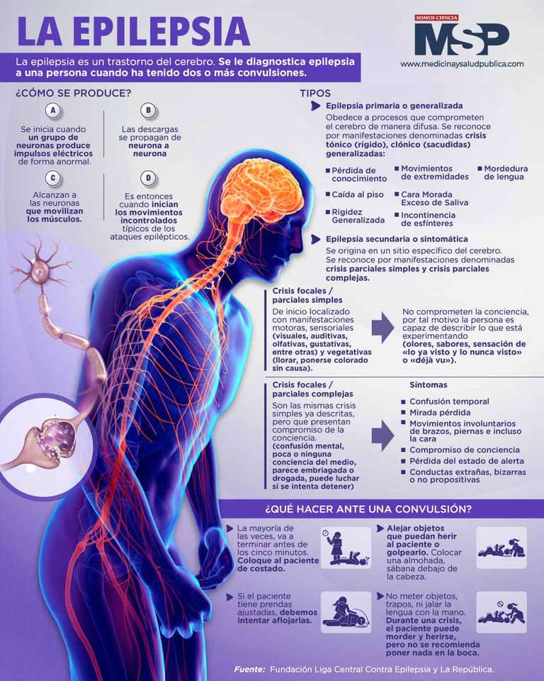 epilepsy - online puzzle