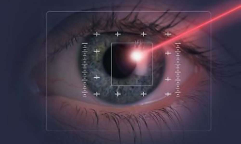 Chirurgia oculare puzzle online