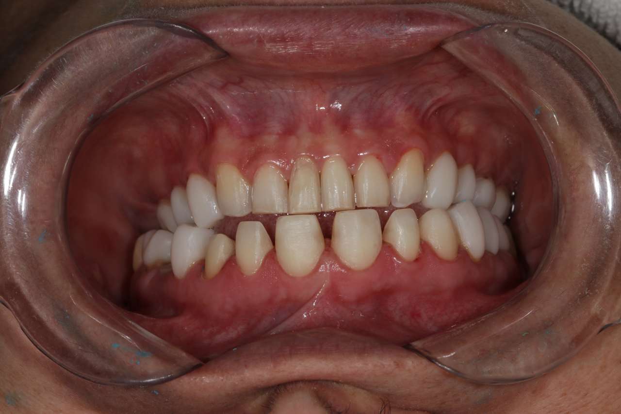 хубави зъби онлайн пъзел