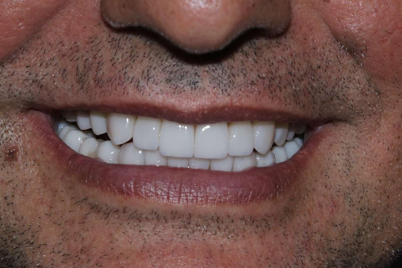 гарні зуби пазл онлайн