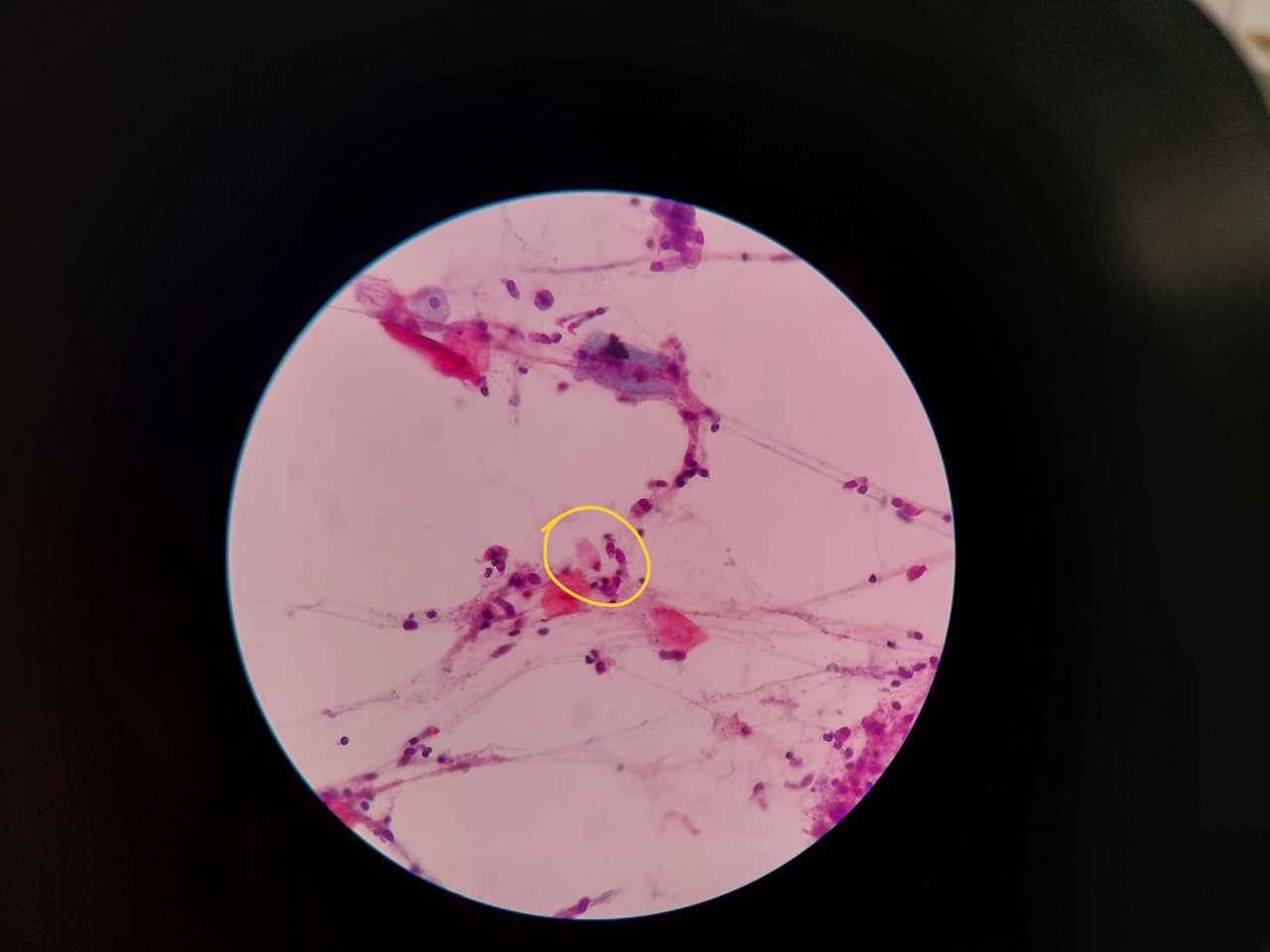 cytological sample online puzzle