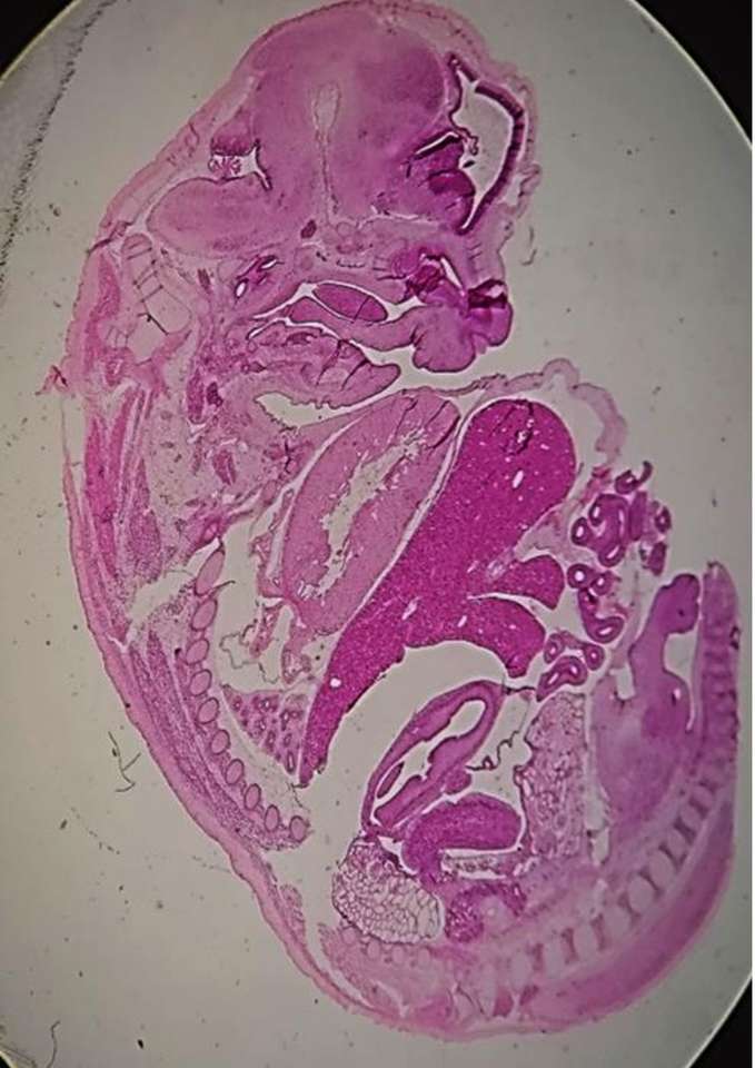 EMBRYOLOGY PUZZLE rompecabezas en línea