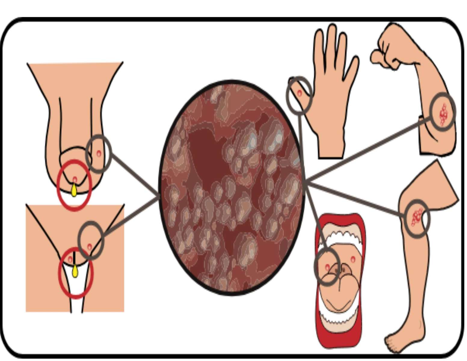 DISEASE jigsaw puzzle online