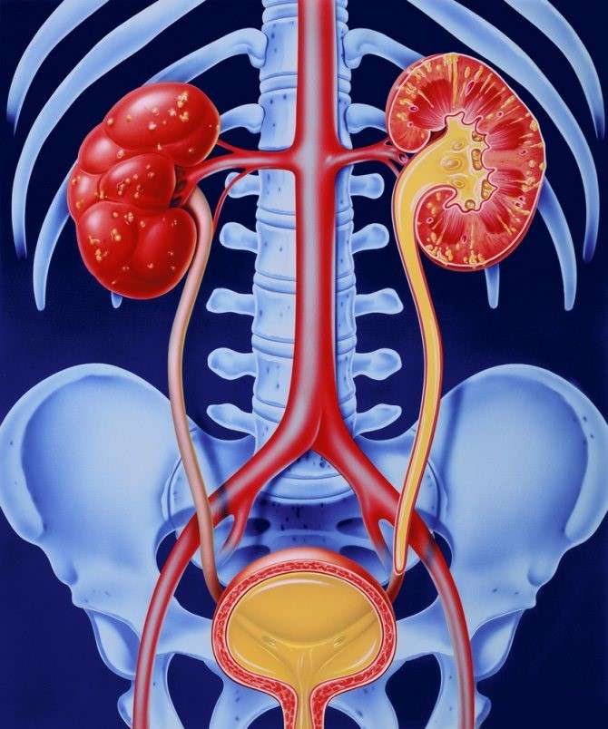 腎臓と骨格 ジグソーパズルオンライン