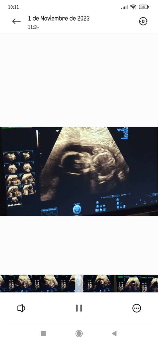 baby ultrasound jigsaw puzzle online