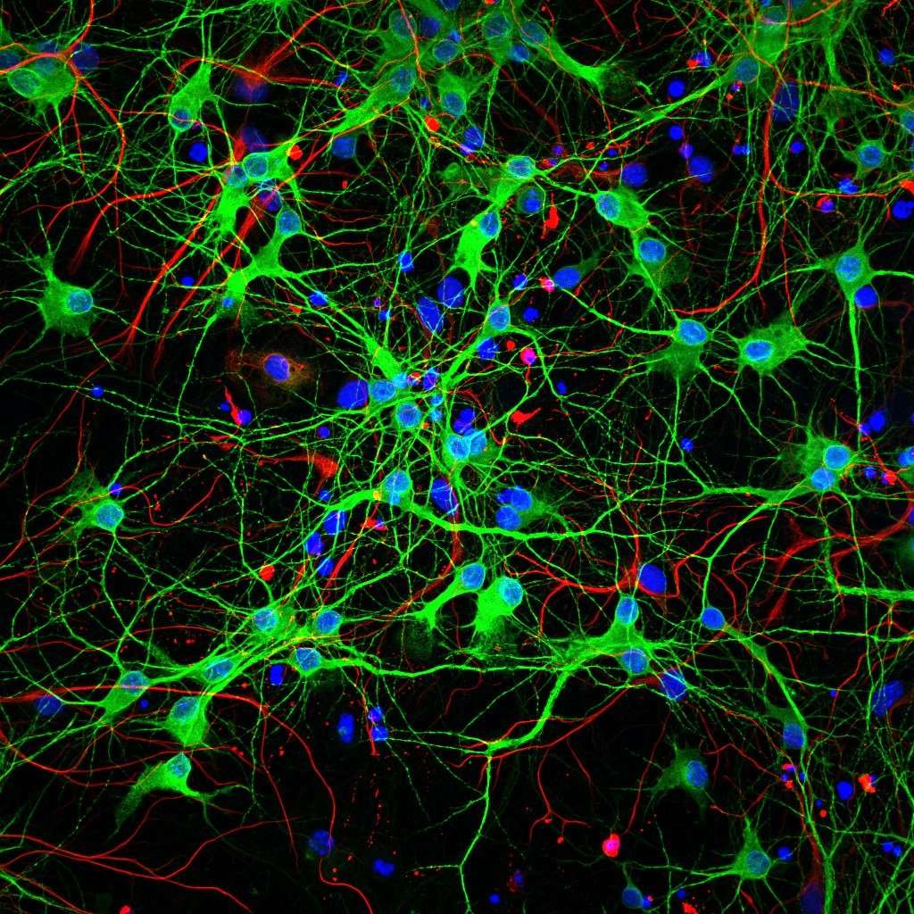 Соединить картинки нейросеть. Нейронная сеть. Нейронные связи. Искусственная нейронная сеть. Нейронная сетка.