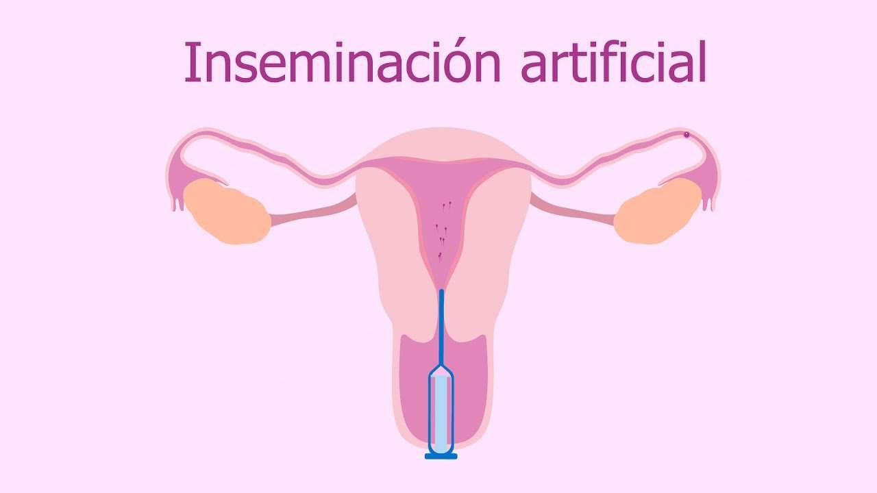 Artificiell insemination Pussel online