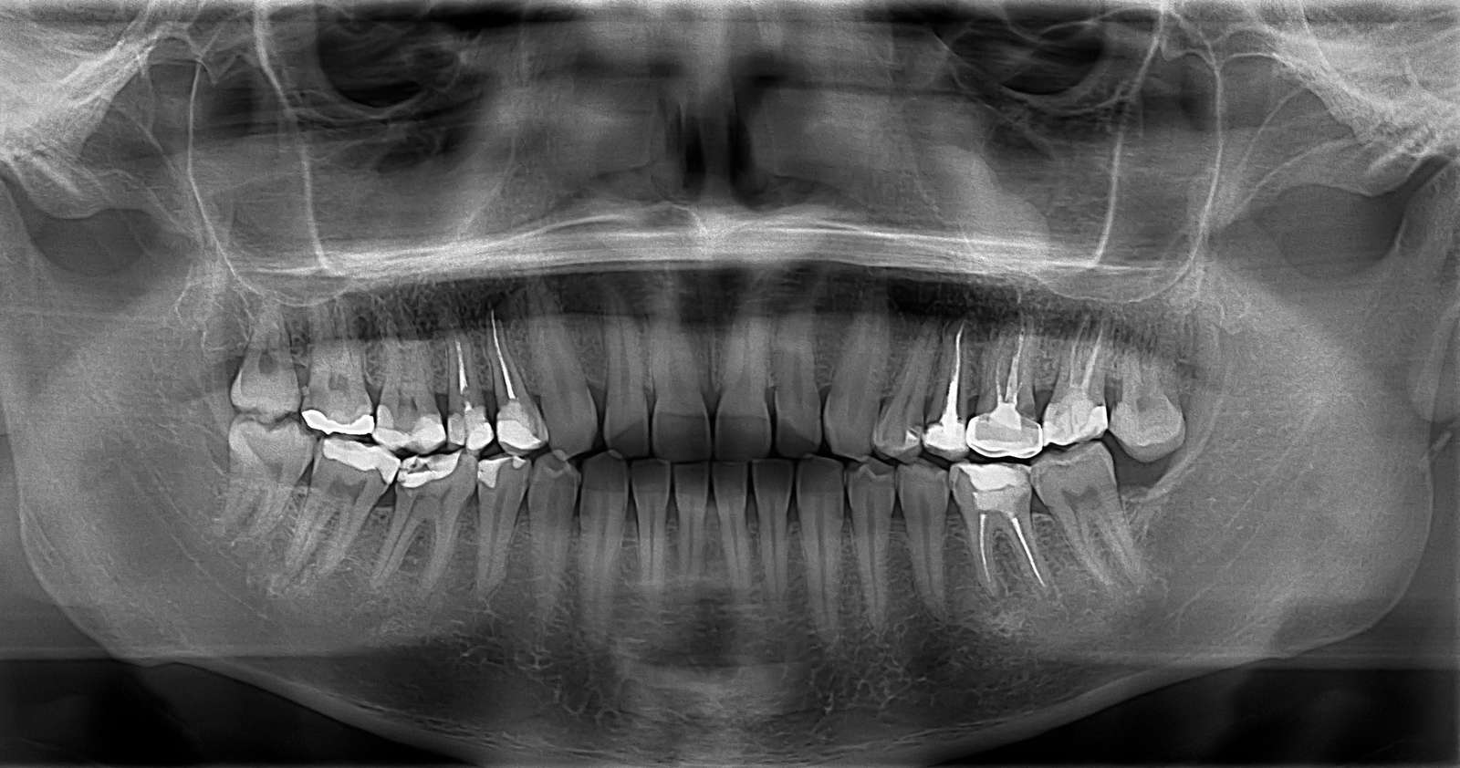 DENTAL PUZZLE online puzzle