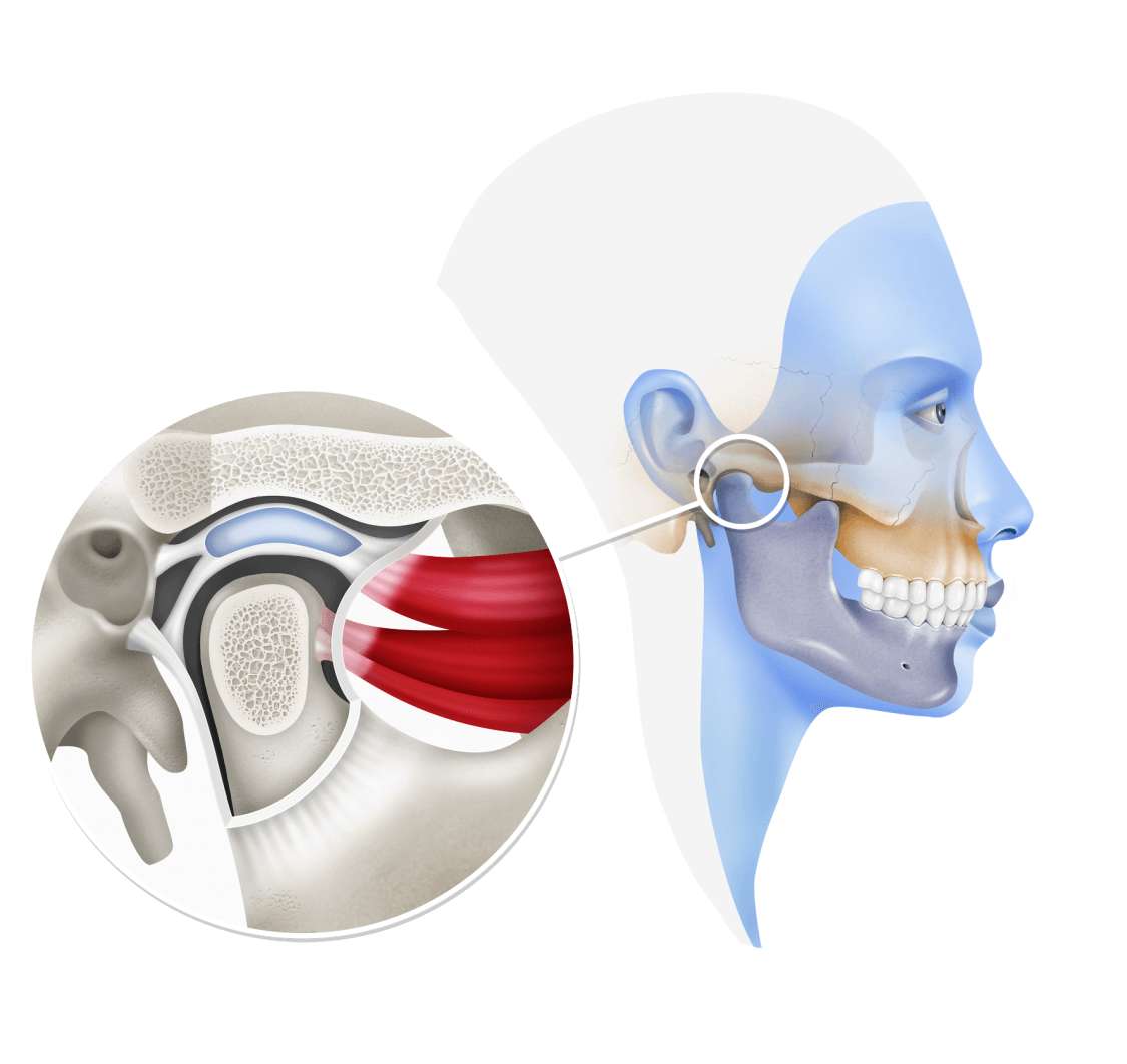 Articulation temporo-mandibulaire puzzle en ligne